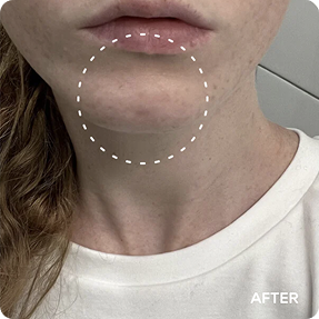 Renewal Rejuvenation Toner Pads